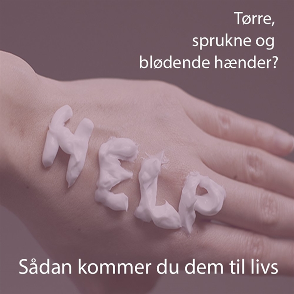 Vinter hænder